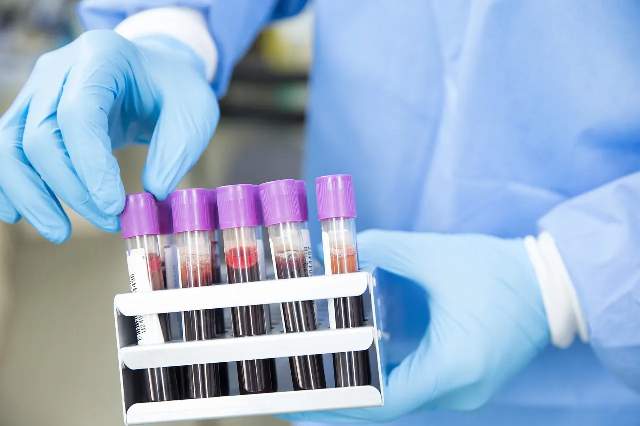sample, lab, laboratory, scientist, medical, health, test, science, healthcare, research, tube, blue health, blue medical, blue science, blue research, blue lab, blue test, blue bl. Medical courier KPIs owners should track monthly