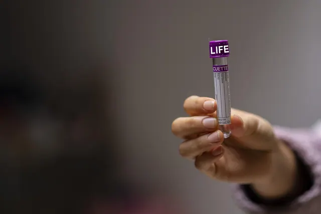 test tube, tube, laboratory, lab, science, medical, labor, chemistry, test tube, test tube, test tube, test tube, test tube, laboratory, lab. Medical courier pay rates and labor costs