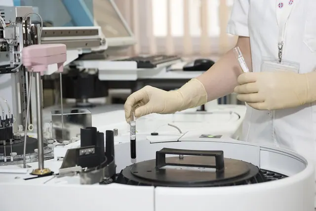 sample, lab, laboratory, scientist, test, medical, healthcare, health, research, science, tube, yellow health, yellow medical, yellow science, yellow research, yellow lab, yellow t