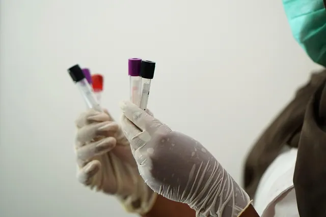 laboratory, test tubes, medical staff, researcher, coronavirus, pandemic, lab test, blood sample, blood specimen, test tubes, medical staff, medical staff, medical staff, medical s. Medical courier proposal template with scope and fees