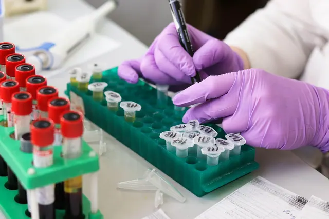 laboratory, medical, medicine, hand, research, lab, test, doctor, equipment, scientist, woman, chemistry, science, hospital, experiment, person, technician, technology, healthcare,. Quoting a medical courier business job: template and real numbers