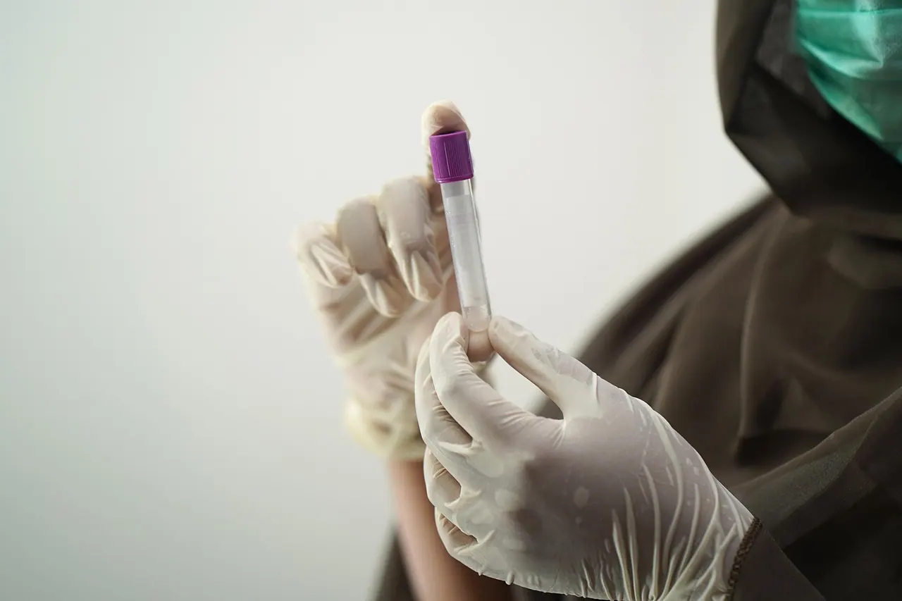 blood test, blood sample, medical technology, medical technologist, surgical gloves, face mask, sample, hospital worker, laboratory, lab, blood test, blood test, blood test, blood 